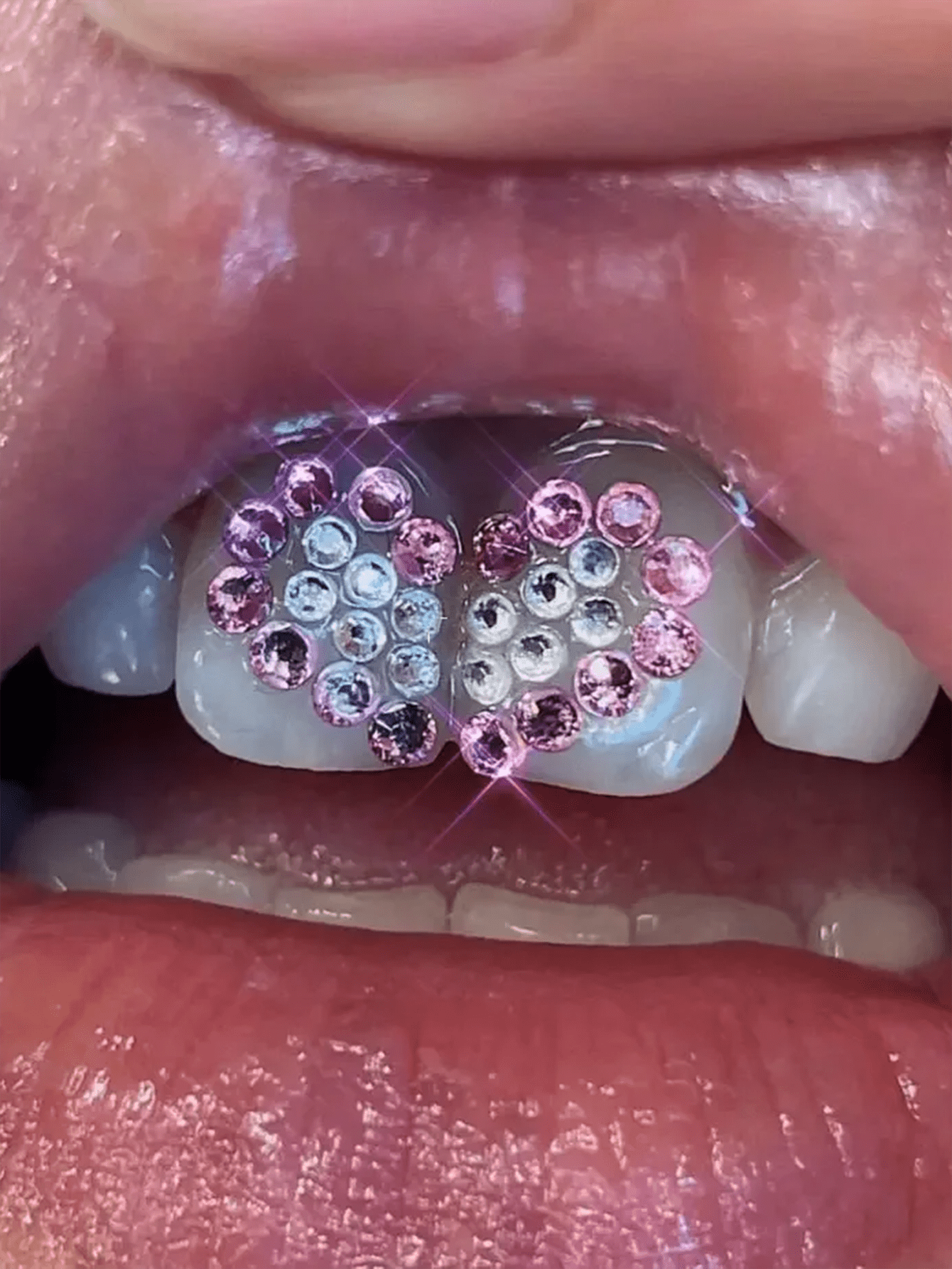 Strass pour les dents coeur violet